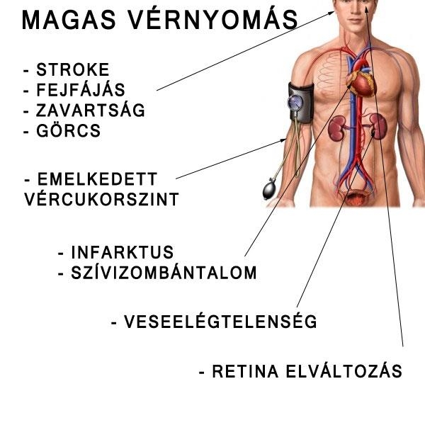 Magas vérnyomás