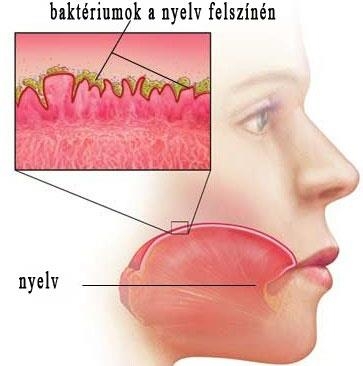 A kellemetlen szájszag, rossz lehelet