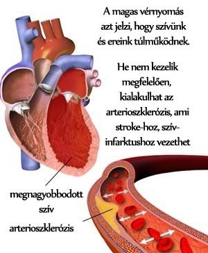 Cukor vs. magas vérnyomás betegség