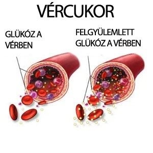 Ideális vércukor értékek