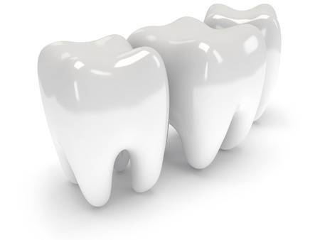 15 házikészítésű orvosság, ha hirtelen éri a fogfájás