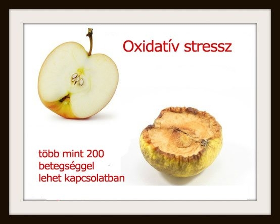 Oxidatív stressz