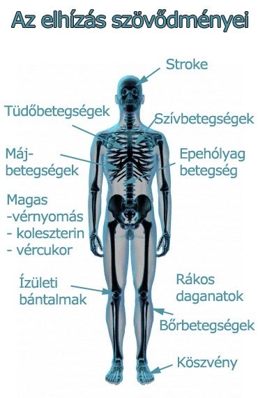 Az elhízás szövődményei