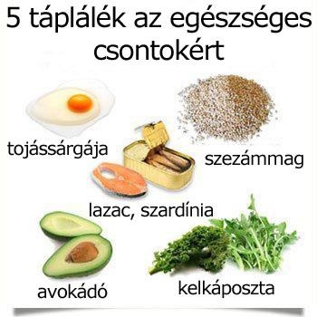 5 táplálék az egészséges csontokért