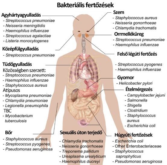 Bakteriális fertőzések