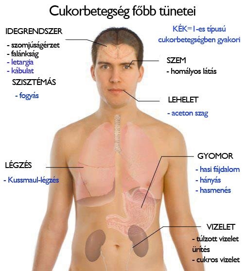 A cukorbetegség főbb tünetei