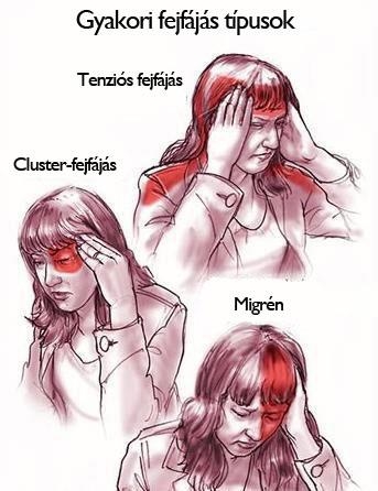 Fejfájás