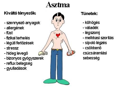 Asztma