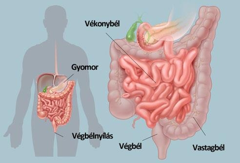 Előzzük meg a vastagbélrákot!