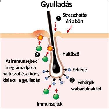 Hajhullás, kopaszodás
