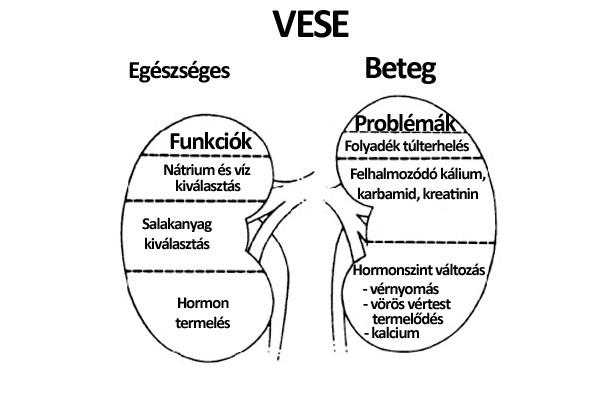 Vese betegségek