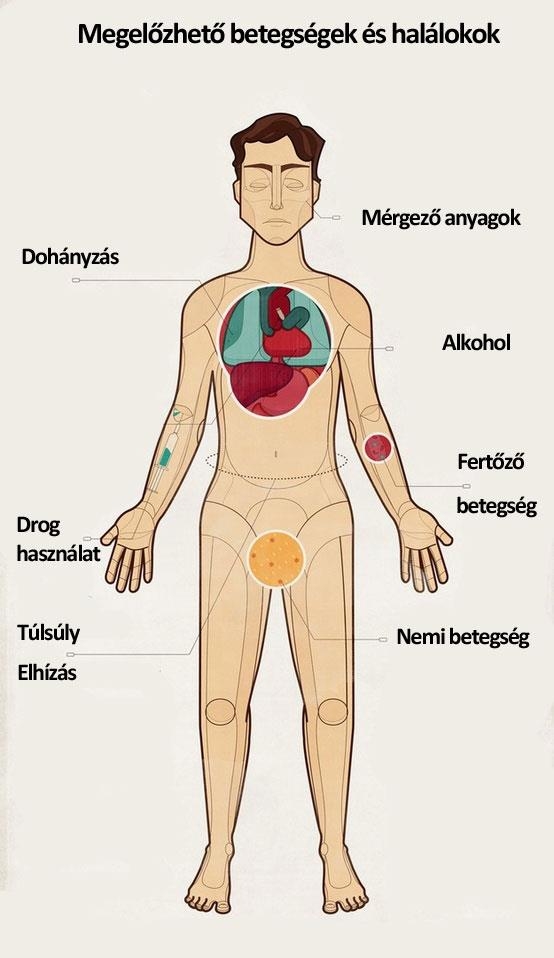 Megelőzhető betegségek