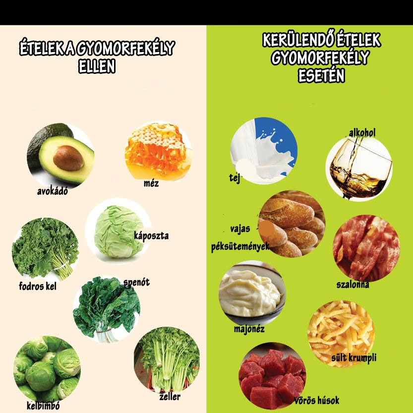 Ételek gyomorfekély ellen