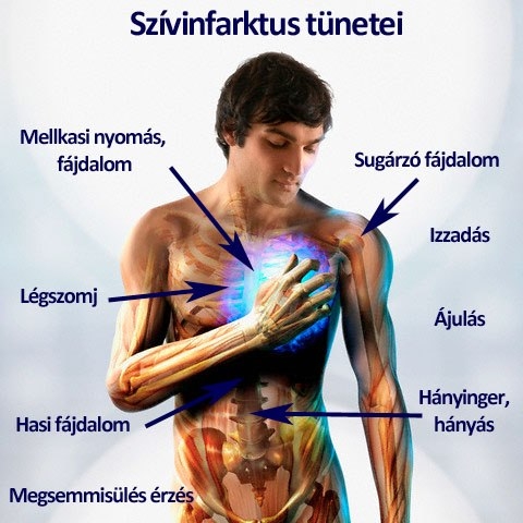 Szívinfarktus tünetei