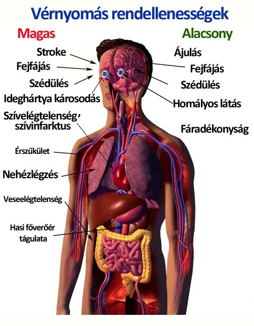 Vérnyomás rendellenességek