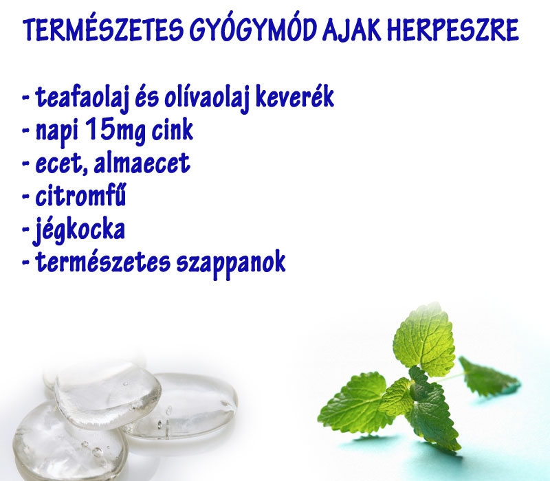 Természetes gyógymód ajakherpeszre