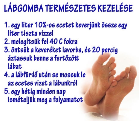 Lábgomba természetes kezelése
