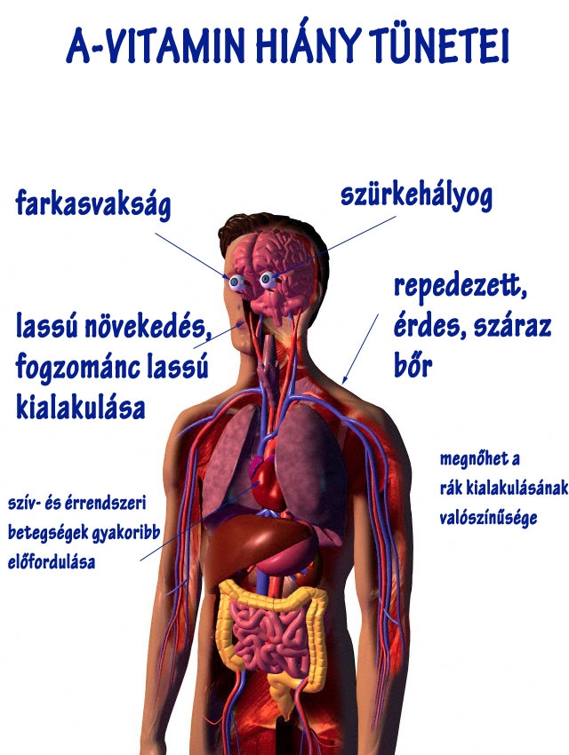 A-vitamin hiány tünetei