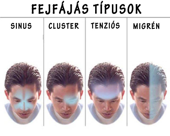 Fejfájás típusok