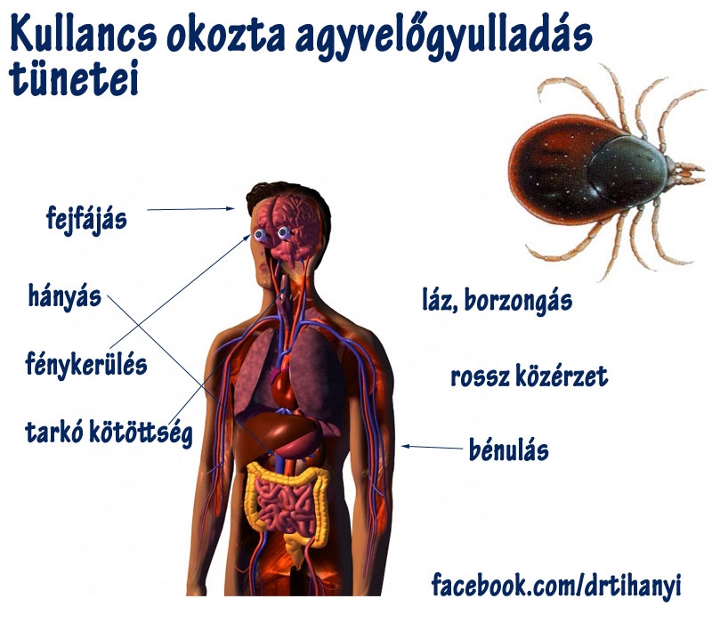 A kullancs okozta agyvelőgyulladás