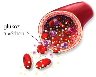 A túlzott finomított cukor- és szénhidrátbevitel jelentősen növeli a szívbetegségek kockázatát?