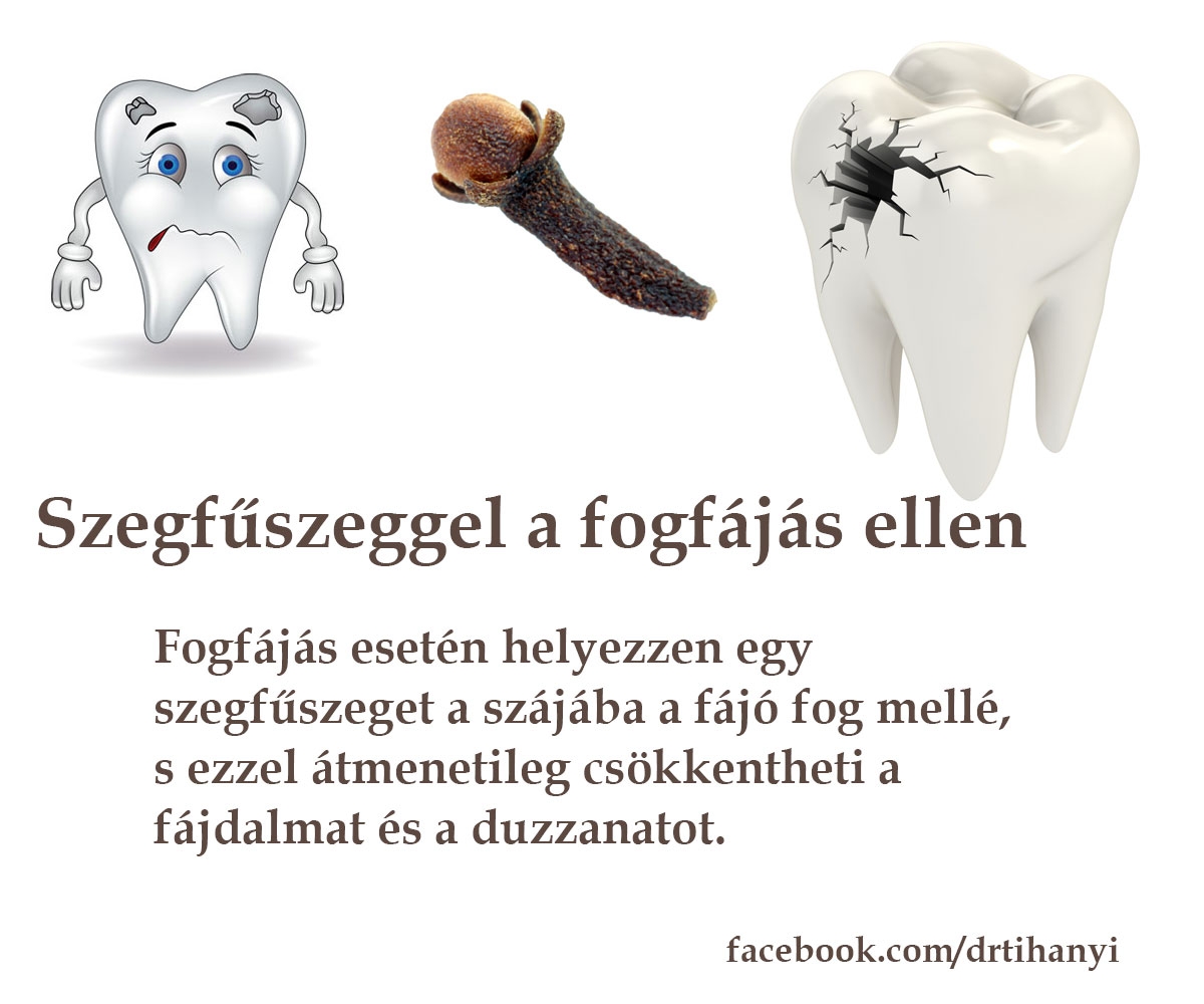 Szegfűszeg fogfájás ellen