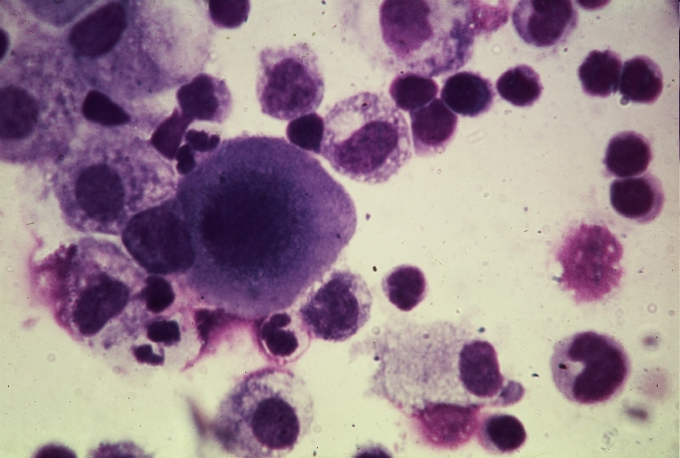 A rák részben sejtek mutációja