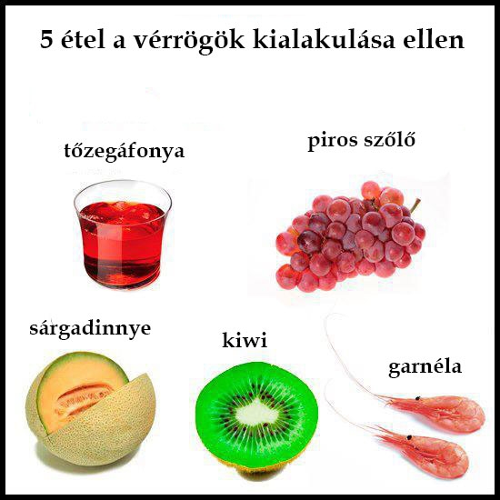 5 étel a vérrögök kialakulása ellen