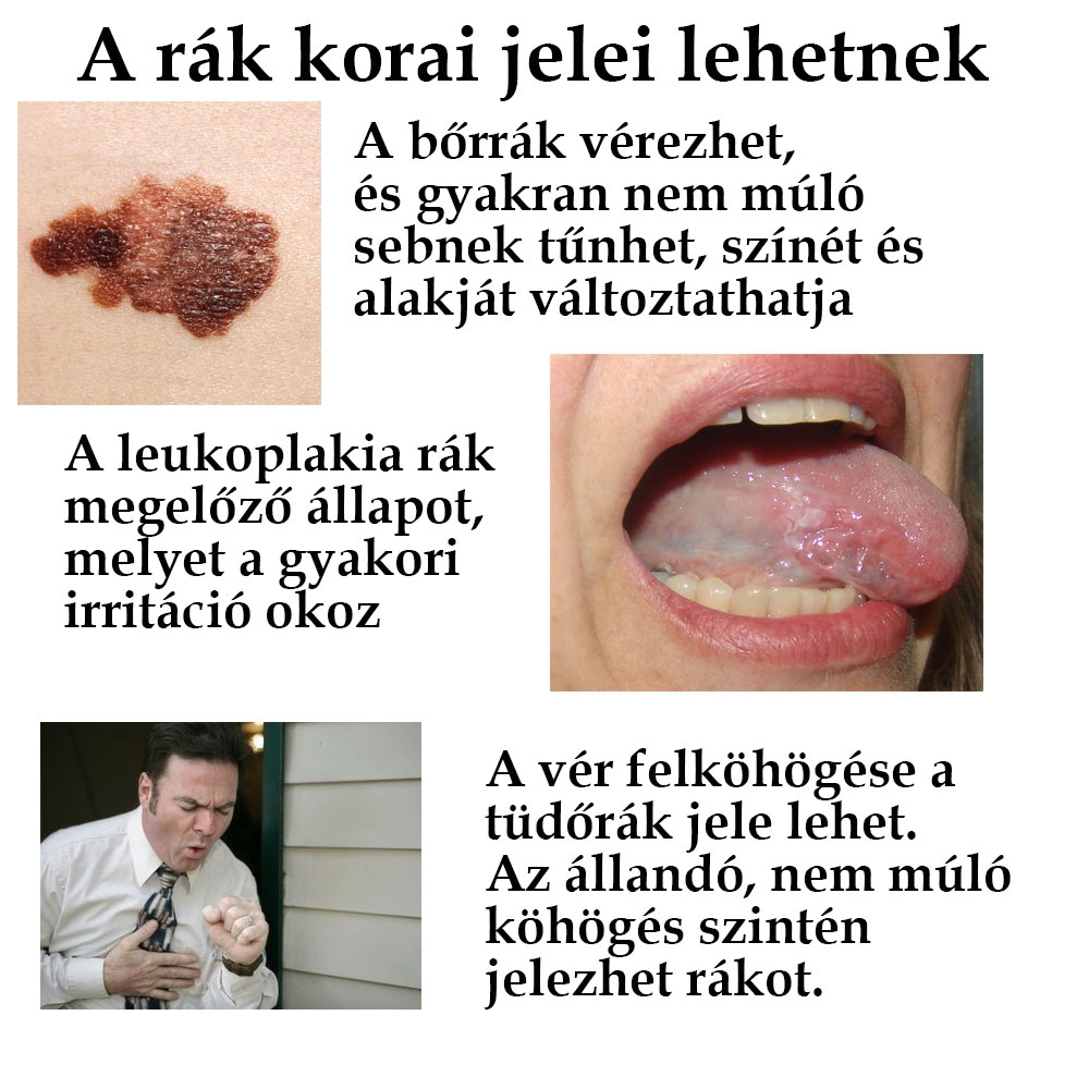 A rák korai jelei lehetnek