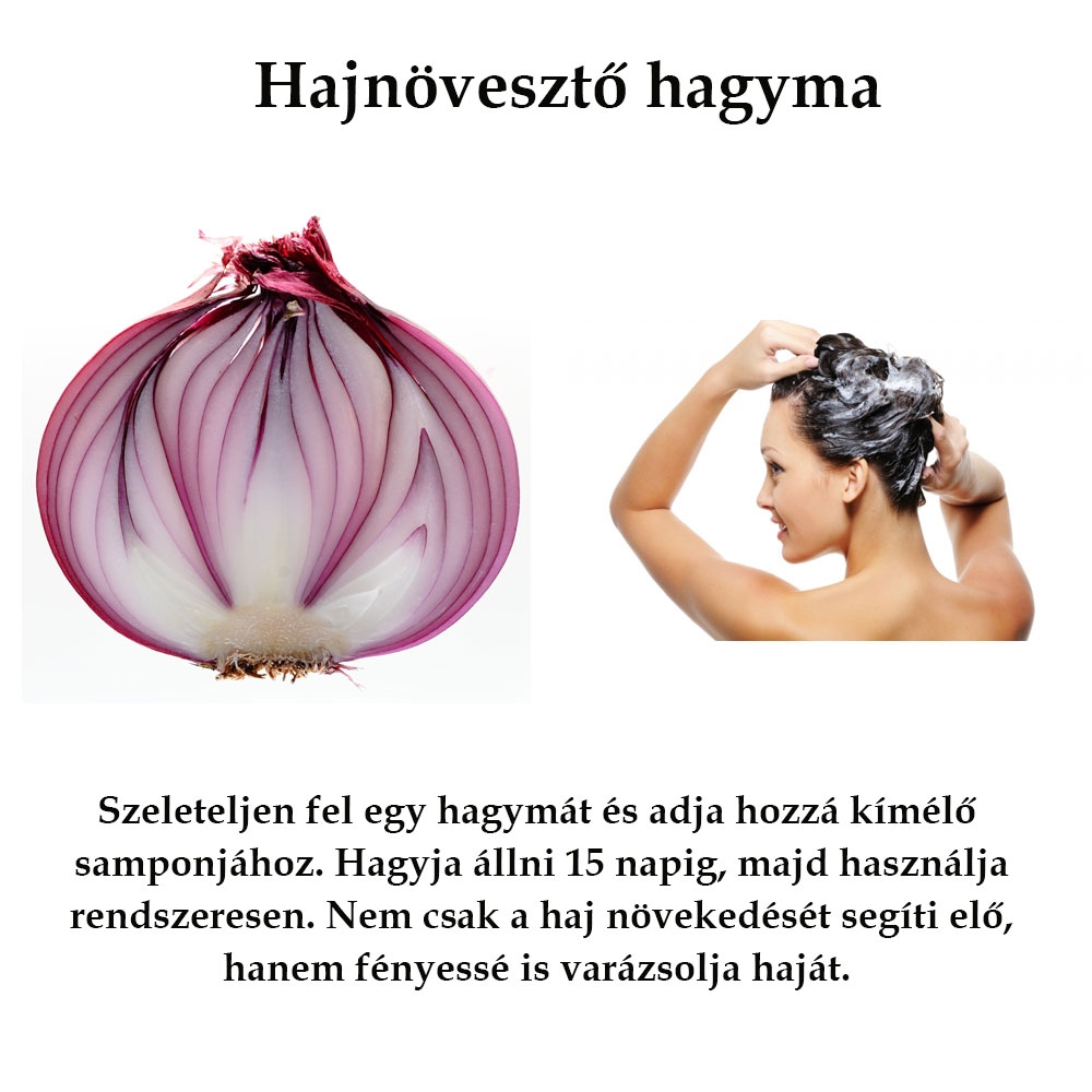 Hajnövesztő hagyma