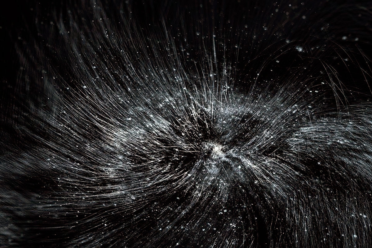 A nagymértékű korpásodás