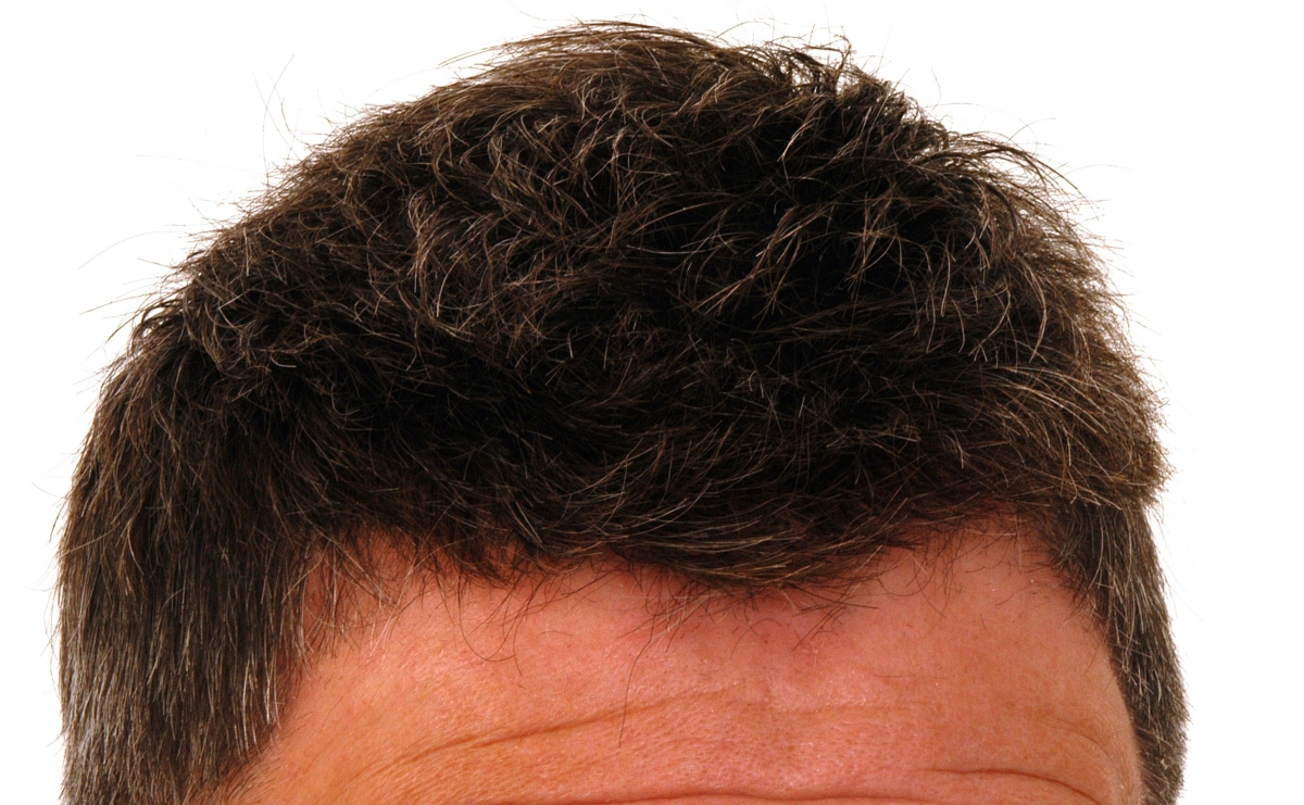 Hajhullás főbb kiváltó okai