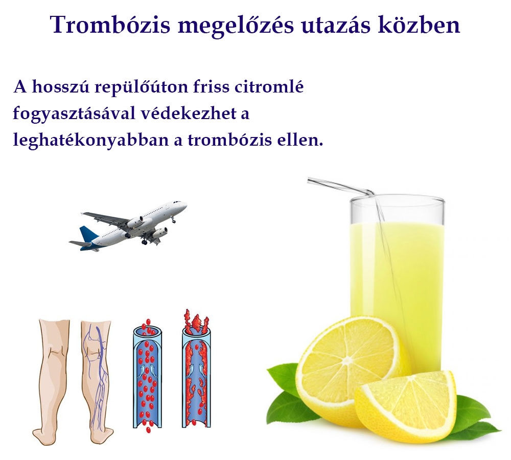 Trombózis megelőzés utazás közben