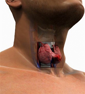 Otthoni gyógymódok pajzsmirigy-túlműködés kezelésére