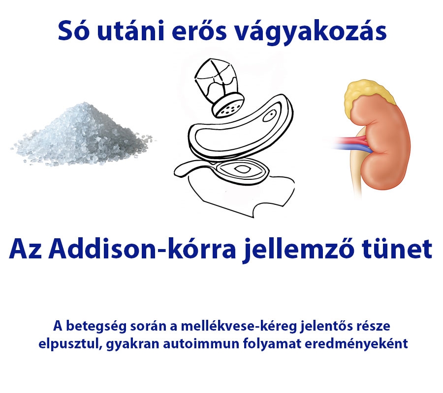 Só utáni erős vágyakozás