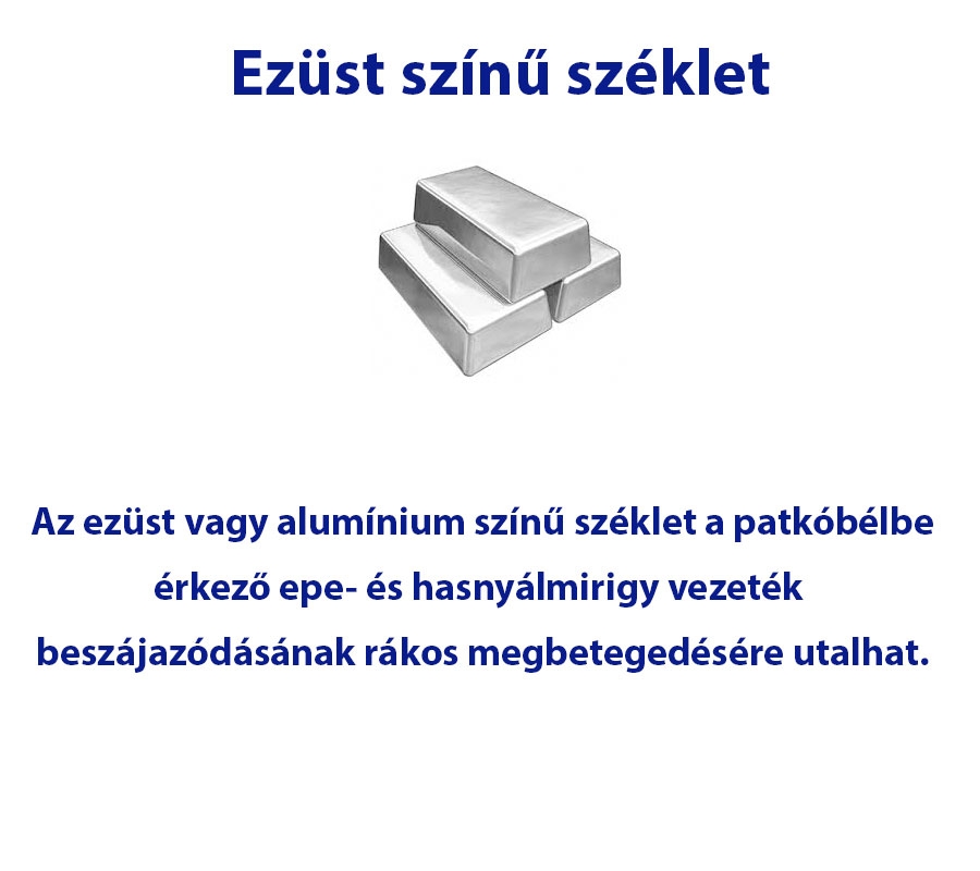 Ezüst színű széklet