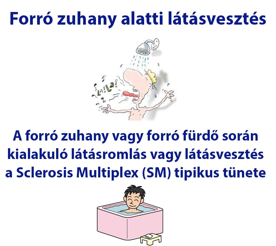 Forró zuhany alatti látásvesztés