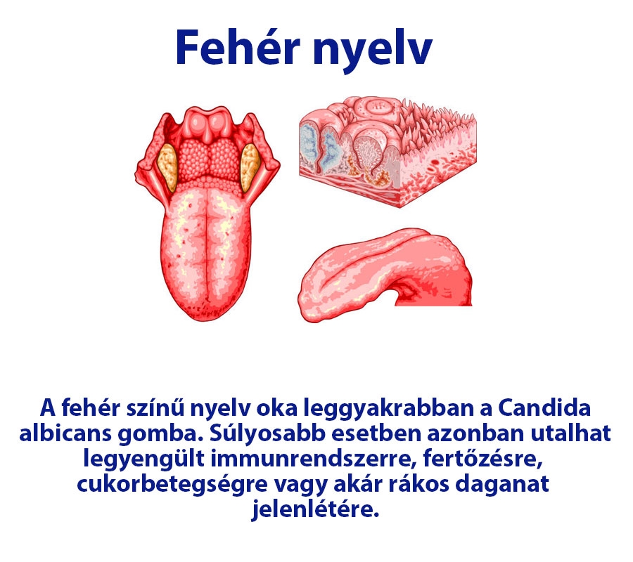 Fehér nyelv