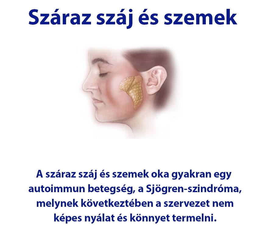 Száraz száj és szemek