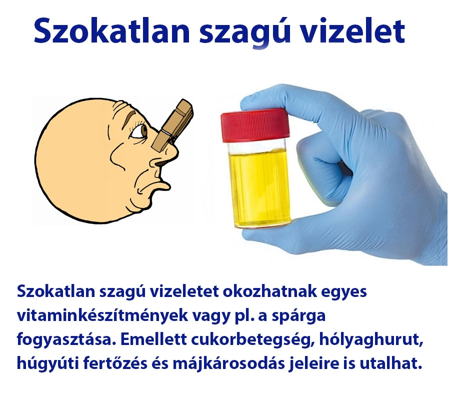 Szokatlan szagú vizelet