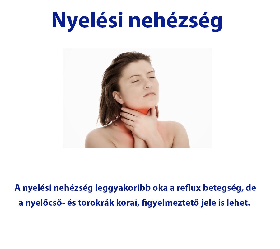 Nyelési nehézség