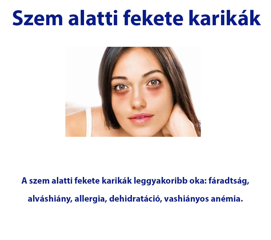 Szem alatti fekete karikák