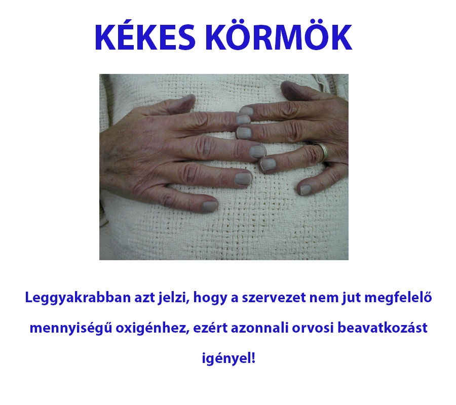 KÉKES KÖRMÖK