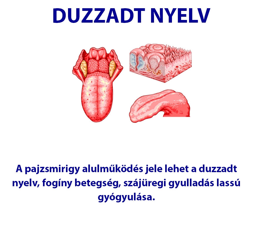 Duzzadt nyelv