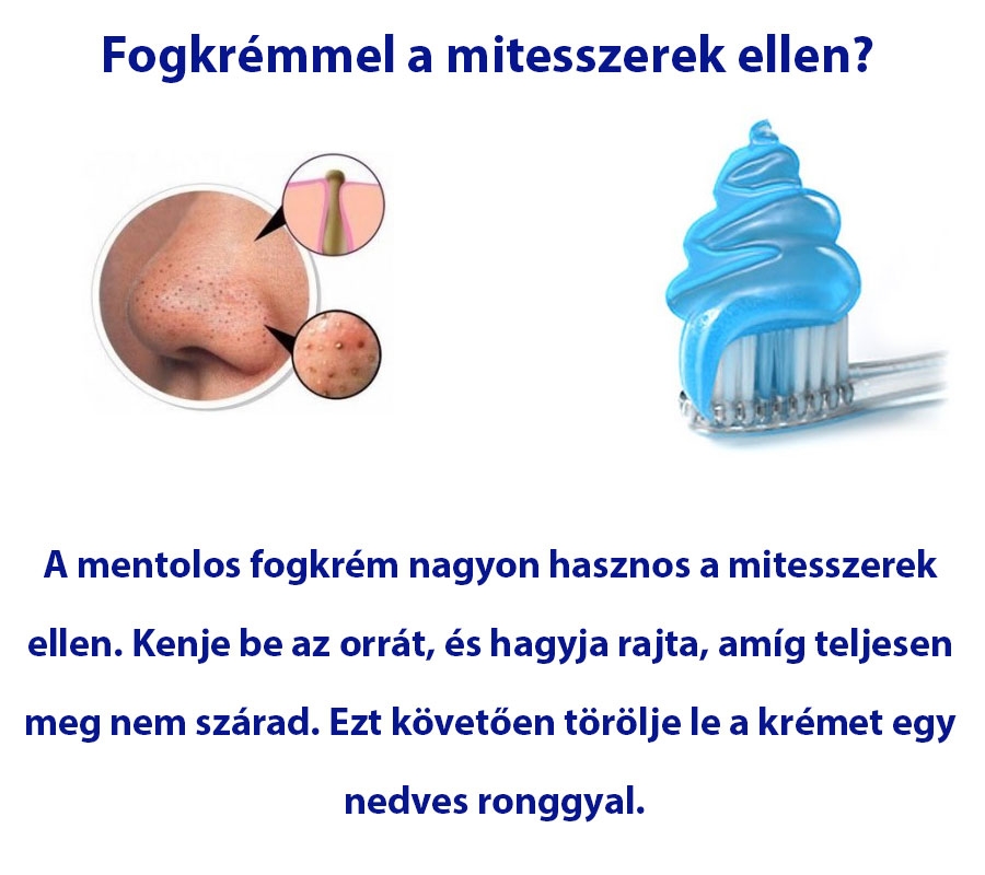 Fogkrémmel a mitesszerek ellen?