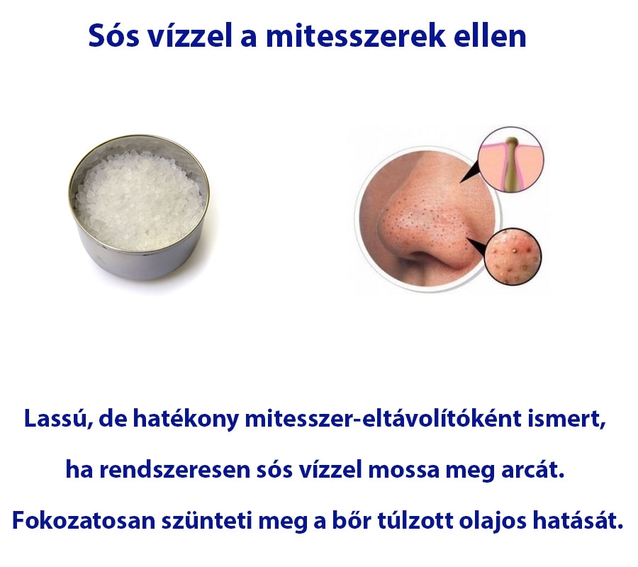 Sós vízzel a mitesszerek ellen