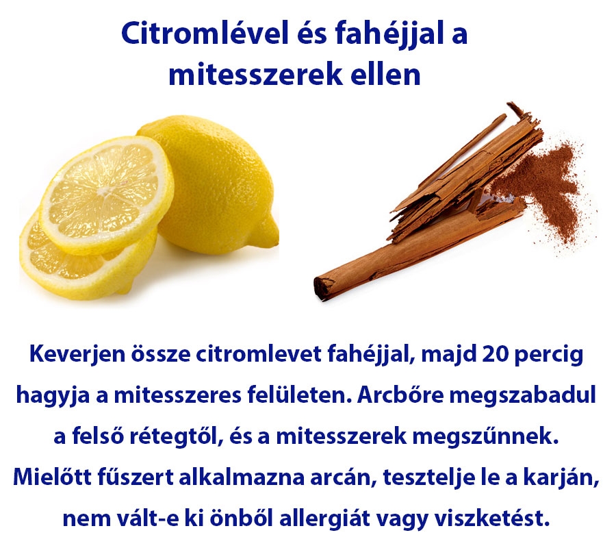 Citromlével és fahéjjal a mitesszerek ellen
