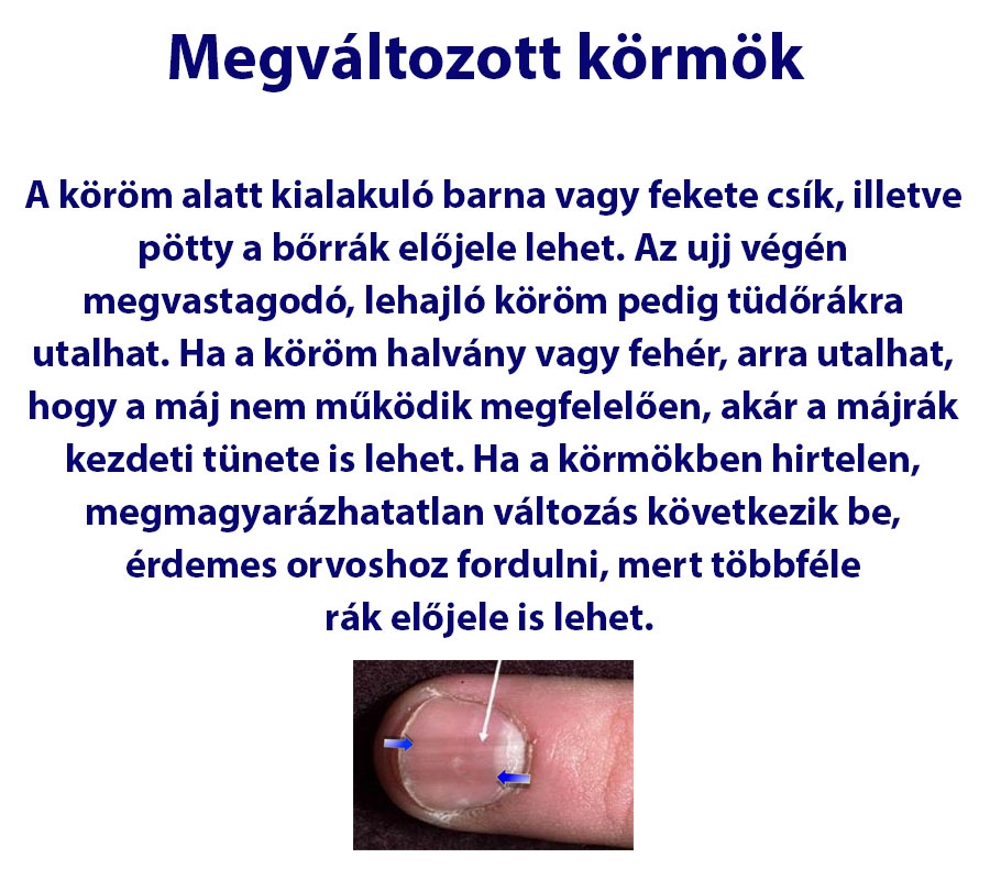 Megváltozott körmök