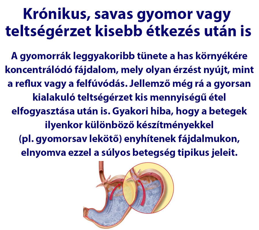 Krónikus, savas gyomor vagy teltségérzet kisebb étkezés után is