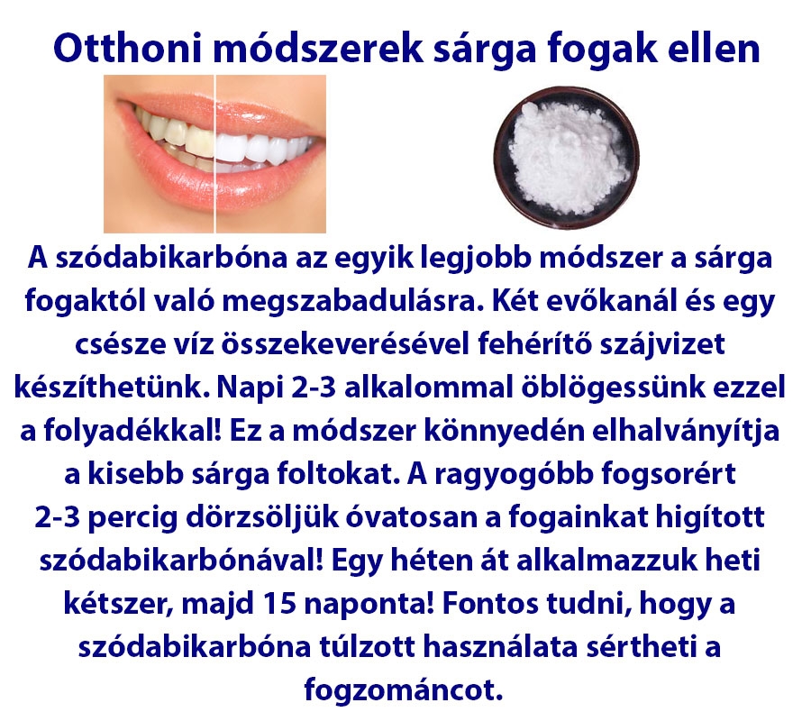 Otthoni módszerek sárga fogak ellen